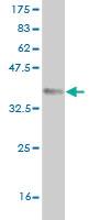 Anti-QPCT Mouse Monoclonal Antibody [clone: 4E11]