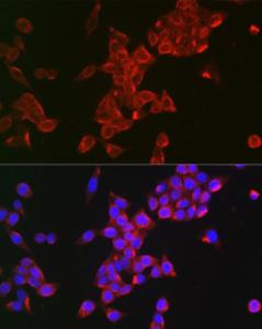 Immunofluorescence analysis of HeLa using Anti-FSH-R Antibody (A11453) at a dilution of 1:100 (40x lens). DAPI was used to stain the cell nuclei (blue).