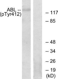 Western blot analysis of lysates from RAW264.7 cells using Anti-Abl (phospho Tyr393 + Tyr412) Antibody. The right hand lane represents a negative control, where the antibody is blocked by the immunising peptide