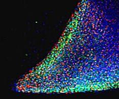 Anti-NANOG Antibody (A84113) (5 µg/ml) staining (green) parts of a colony of induced pluriform stem cells derived from Human Keratinocytes