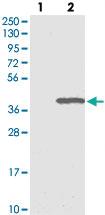 Anti-ERGIC1 Rabbit Polyclonal Antibody