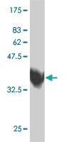 Anti-ZNF207 Mouse Monoclonal Antibody [clone: 5G6]