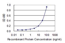 Anti-IRF2 Polyclonal Antibody Pair