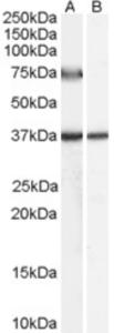 EB07667 (0.5 µg/ml) staining of Human Liver lysate (35 µg protein in RIPA buffer) with (B) and without (A) blocking with the immunising peptide.  Primary incubation was 1 hour.  Detected by chemiluminescence.