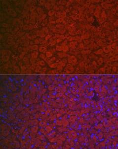 Immunofluorescence analysis of rat ovary using Anti-FSH-R Antibody (A11453) at a dilution of 1:100 (40x lens). DAPI was used to stain the cell nuclei (blue).