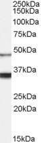 Anti-HCRTR1 Antibody (A84114) (0.1 µg/ml) staining of Human Brain lysate (35 µg protein in RIPA buffer). Primary incubation was 1 hour. Detected by chemiluminescence