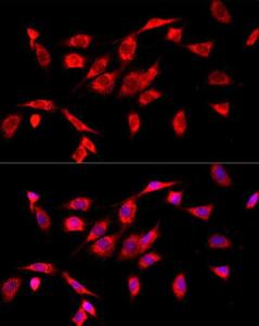 Immunofluorescence analysis of NIH/3T3 cells using Anti-COX IV Antibody (A309799) at a dilution of 1:50 (40X lens). DAPI was used to stain the cell nuclei (blue)