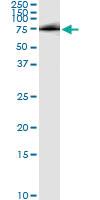 Anti-HHIP Antibody Pair