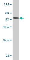 Anti-ADA Mouse Monoclonal Antibody [clone: 4G4-1C6]