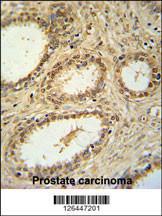 Anti-SNRNP40 Rabbit Polyclonal Antibody (Biotin)