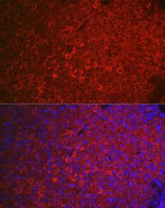 Immunofluorescence analysis of mouse ovary using Anti-FSH-R Antibody (A11453) at a dilution of 1:100 (40x lens). DAPI was used to stain the cell nuclei (blue).