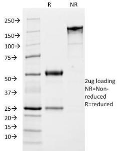 SDS-PAGE analysis of Anti-Growth Hormone Antibody [SPM106] under non-reduced and reduced conditions; showing intact IgG and intact heavy and light chains, respectively. SDS-PAGE analysis confirms the integrity and purity of the antibody.