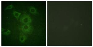 Immunofluorescence analysis of HUVEC cells using Anti-BIK Antibody. The right hand panel represents a negative control, where the Antibody was pre-incubated with the immunising peptide