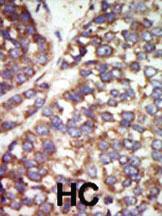 Anti-PAK2 Rabbit Polyclonal Antibody