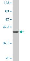 Anti-TPX2 Mouse Monoclonal Antibody [clone: 5E11]