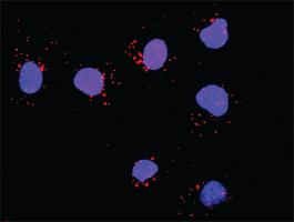 Anti-GAB1 + SOS1 Antibody Pair