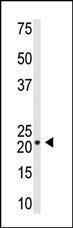 Anti-VSNL1 Rabbit Polyclonal Antibody (Biotin)