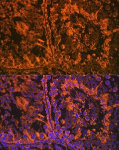 Immunofluorescence analysis of mouse testis using Anti-SRD5A2 Antibody [ARC2287] (A307681) at a dilution of 1:100 (40x lens). DAPI was used to stain the cell nuclei (blue).