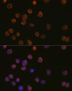 Immunofluorescence analysis of THP-1 cells using Anti-CD11c Antibody (A11454) at a dilution of 1:100 (40x lens) DAPI was used to stain the cell nuclei (blue)