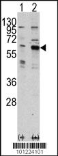 Anti-PAK3 Rabbit Polyclonal Antibody