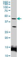 Anti-LEF1 Mouse Monoclonal Antibody [clone: 2C9]