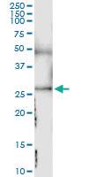 Anti-SDC4 Polyclonal Antibody Pair