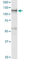 Anti-GTF2IRD1 Polyclonal Antibody Pair