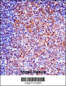 Anti-ZAP70 Rabbit Polyclonal Antibody