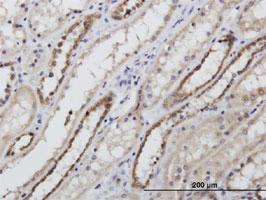 Anti-NIPSNAP3A Rabbit Polyclonal Antibody