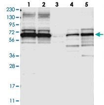 Anti-DNAJC1 Rabbit Polyclonal Antibody