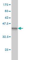 Anti-DAZ1 Mouse Monoclonal Antibody [clone: 3G10]