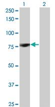 Anti-PRKCD Mouse Monoclonal Antibody [clone: 8E12]