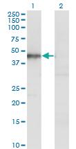 Anti-HOMER1 Mouse Monoclonal Antibody [clone: 2F8]