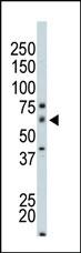 Anti-PAK4 Rabbit Polyclonal Antibody