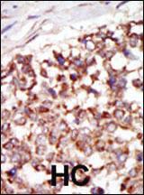 Anti-PAK4 Rabbit Polyclonal Antibody