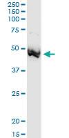 Anti-ADA Polyclonal Antibody Pair