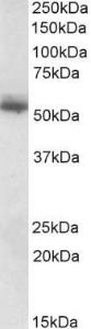 Anti-CPNE1 Antibody (A82619) (0.1µg/ml) staining of Human Skin lysate (35µg protein in RIPA buffer). Primary incubation was 1 hour. Detected by chemiluminescence.