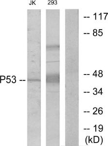 Anti-p53 Rabbit Polyclonal Antibody