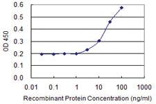 Anti-HOMER1 Mouse Monoclonal Antibody [clone: 2F8]