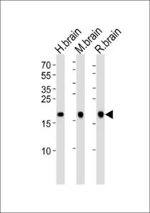 Anti-VSNL1 Rabbit Polyclonal Antibody