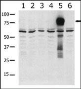 Anti-PAK6 Rabbit Polyclonal Antibody