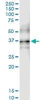 Anti-QPCT Polyclonal Antibody Pair