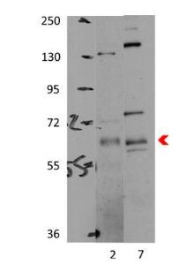 Anti-PRKAA1 Rabbit Polyclonal Antibody