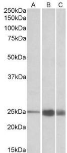 Anti-TNNI2 Goat Polyclonal Antibody