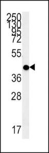 Anti-MC2R Rabbit Polyclonal Antibody (HRP (Horseradish Peroxidase))