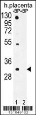 Anti-OR1D5 Rabbit Polyclonal Antibody (HRP (Horseradish Peroxidase))