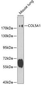 Anti-Collagen V Rabbit Polyclonal Antibody