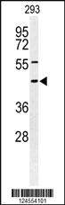 Anti-STX1A Rabbit Polyclonal Antibody