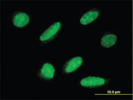 Anti-RPAP3 Mouse Monoclonal Antibody [clone: 1F2]