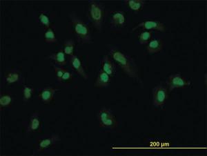 Anti-LEF1 Mouse Monoclonal Antibody [clone: 2C9]